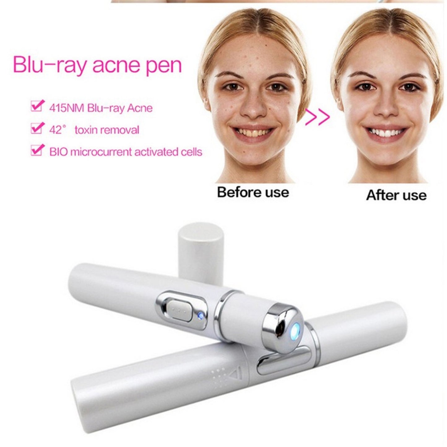 Scar Wrinkle Removal Treatment