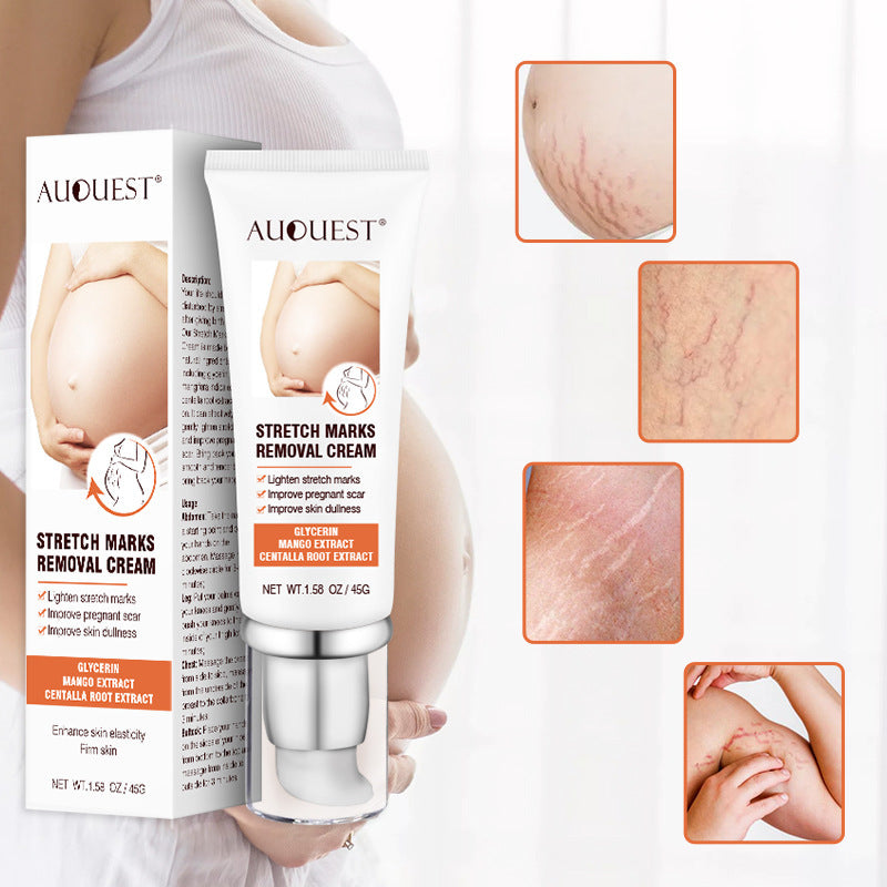 Pregnancy Scars Acne Cream Stretch Mark Treatment