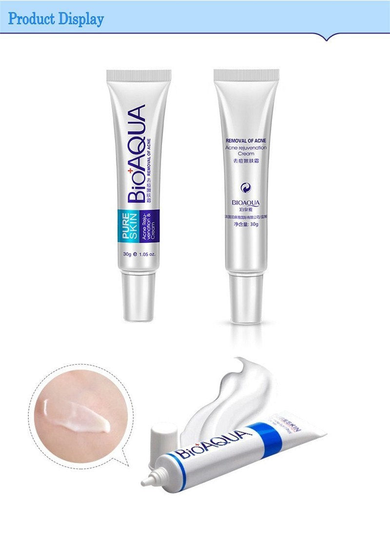Anti Acne Cream Oil Control
