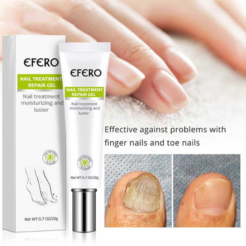 Nail Treatment Serum