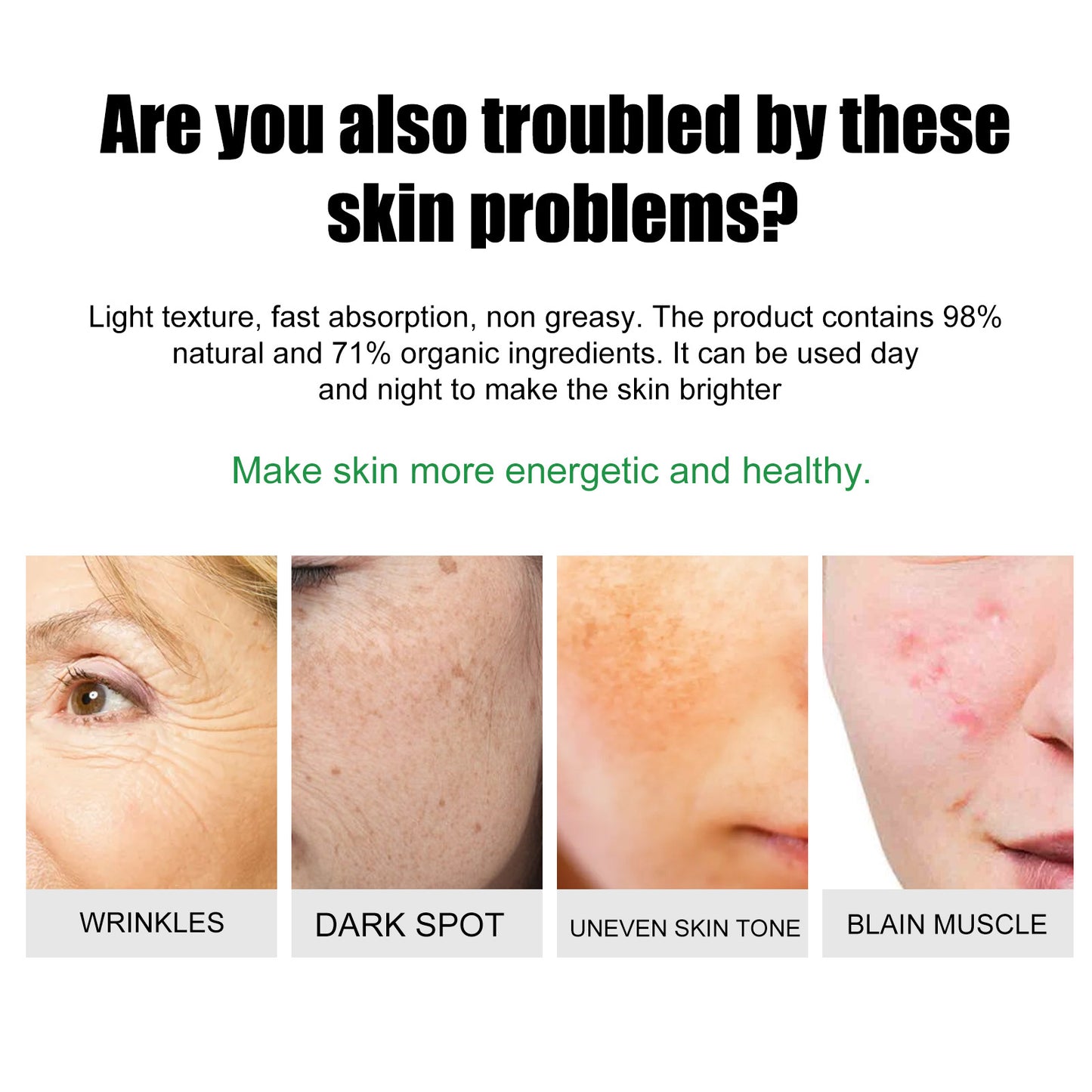 EELHOE Acne & Blemish Cream Lightens