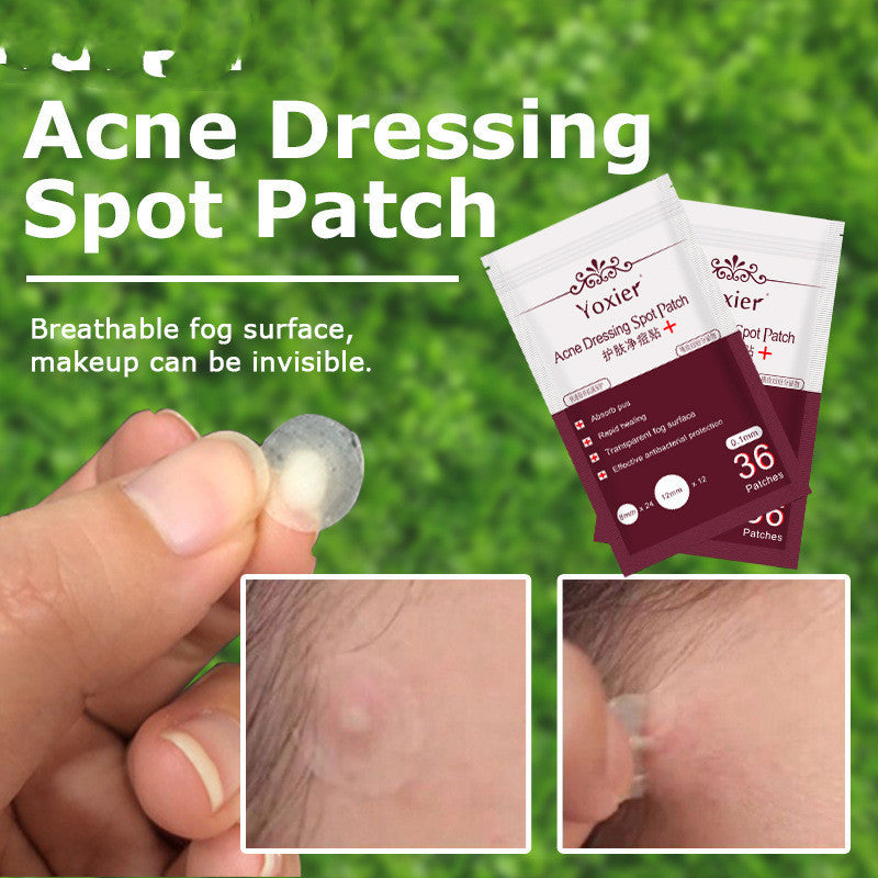 Acne  Blemish Treatment