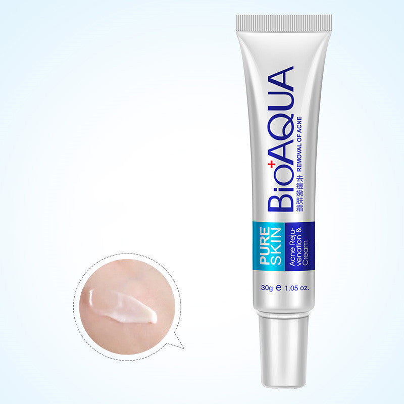 Anti Acne Cream Oil Control