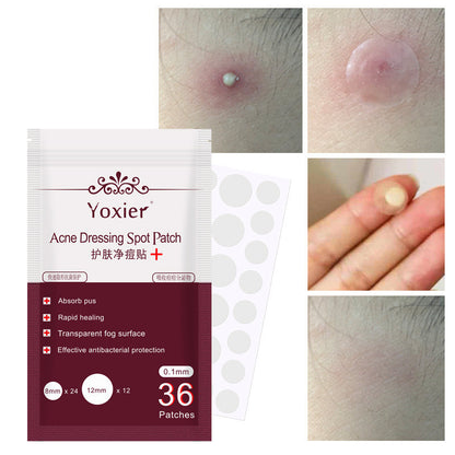 Acne  Blemish Treatment