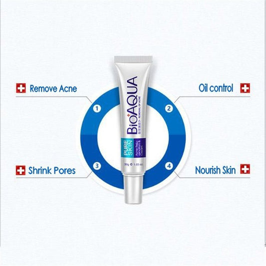 Anti Acne Cream Oil Control
