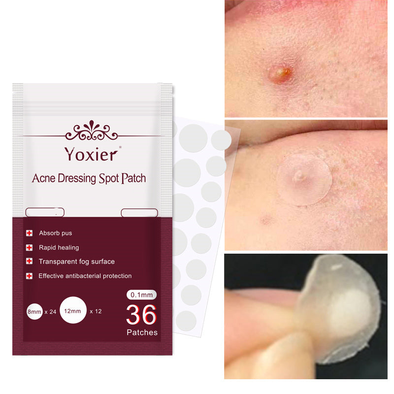 Acne  Blemish Treatment
