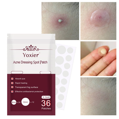 Acne  Blemish Treatment