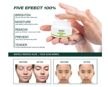 Men's and Women's Oil Control Acne Cream
