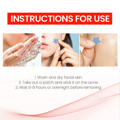 Hydrocolloid Acne Patches
