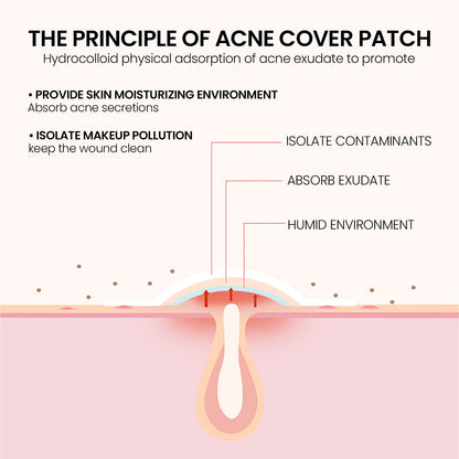 Hydrocolloid Acne Patches